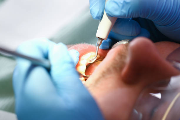 Best Emergency Dental Surgery in Edmore, MI