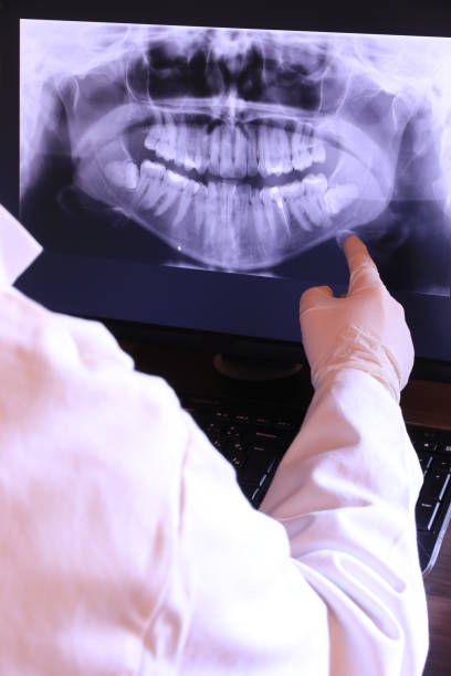 Best Emergency Wisdom Teeth Removal in Edmore, MI